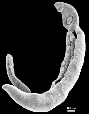 Image: A schistosome pair, with the thin female located in the male gynecophorical canal (Photo courtesy of MetaPathogen).